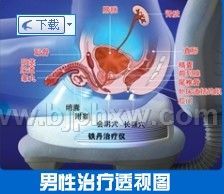 前列腺治疗仪(铁丹治疗仪)——华夏外用产品招商网